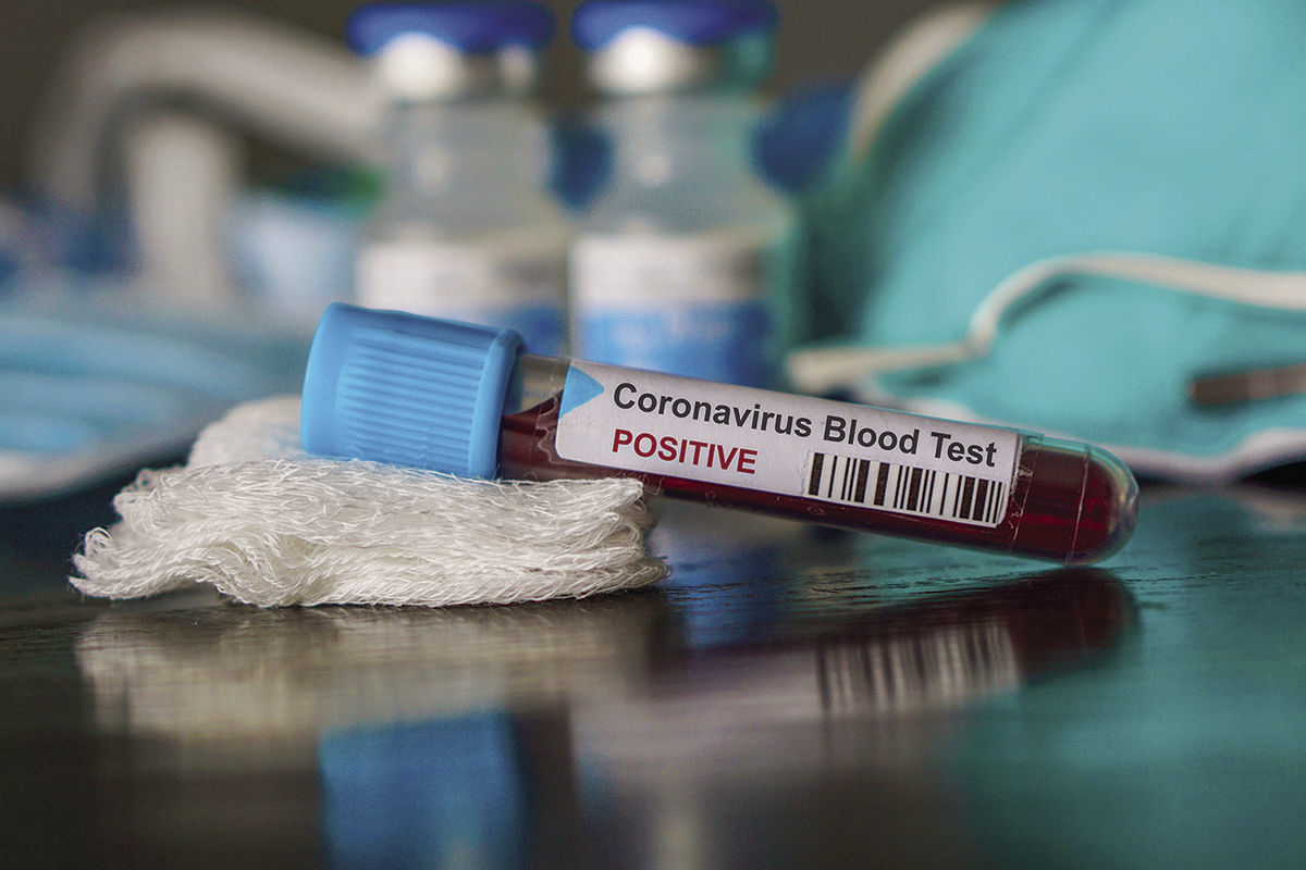 coronavirus bloodtest image